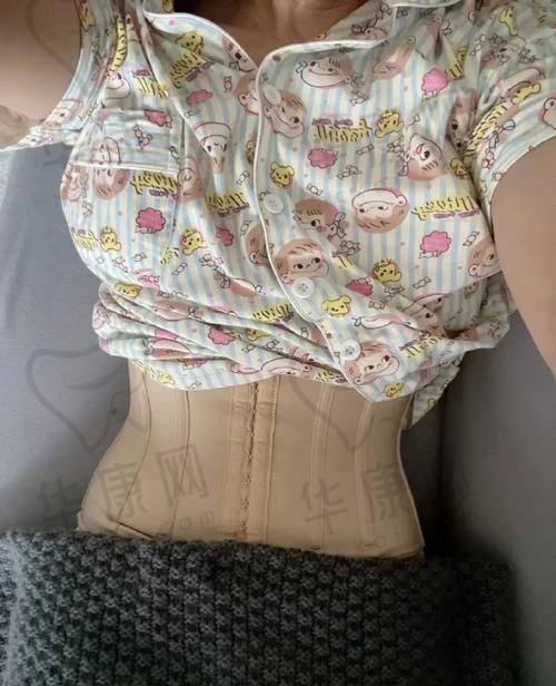 找杭州天鑫医疗美容医院胡柏做大部位环吸真不错，术后腰腹平坦宛如换了个人！