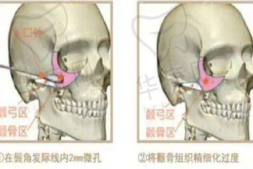 杨水斌医生预约方式