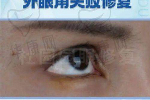 董开云医生特色技术优势