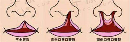 洛阳莱尔美刘战辉院长实力究竟怎样?