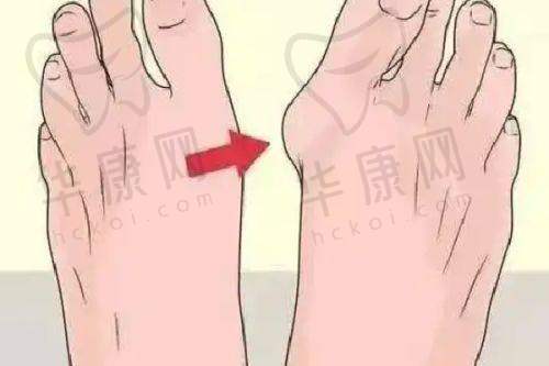 花费1.5W的价值体现