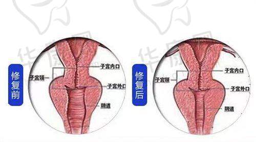 郑小红眼部医生怎么样？擅长多项目，初眼8000起、修复20000起，可多方式预约