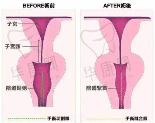 淄博壹美整形美容医院鼻部整形项目价格及成效怎样?