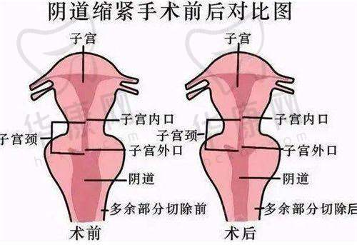 西宁美莱馨怡整形美容医院怎么样，好不好？老牌机构多项目可选，附王娜院长简历