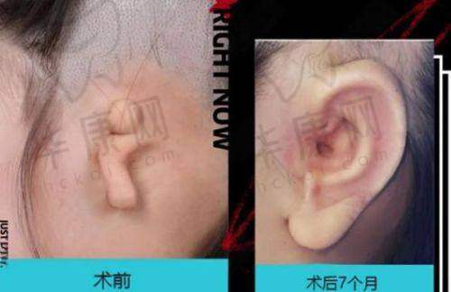 南京新生植发医院的医生水平如何？