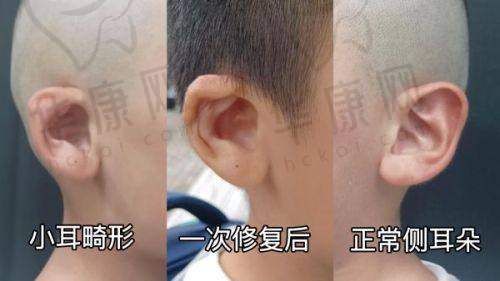 王旭明医生鼻修复怎么样：三维修复技术有何特点？