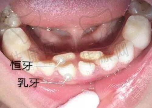 对张永新医生与东莞壹加壹的感激