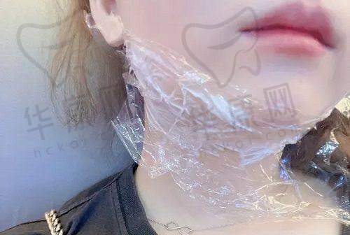 患者口碑：积极的评价与真实体验