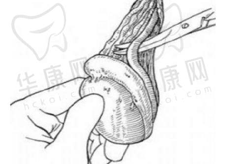吕京陵医生做隆胸技术怎么样?
