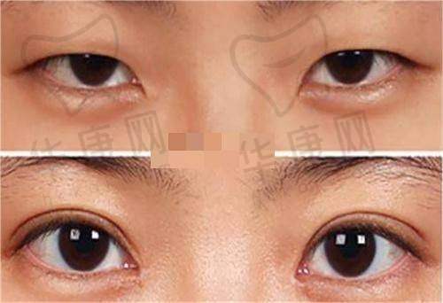 重庆美仑美奂整形美容医院毋巨龙口碑评价