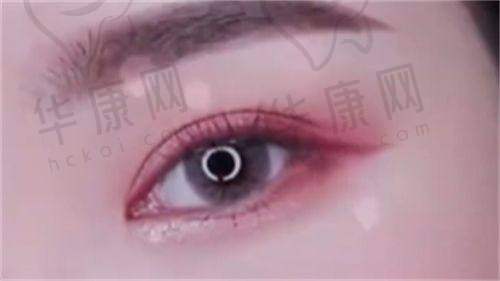 贵阳利美康医院孔令杰临床实例