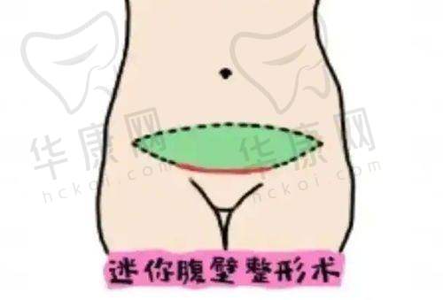 昆明昆大疤痕医院祛疤特色有哪些?