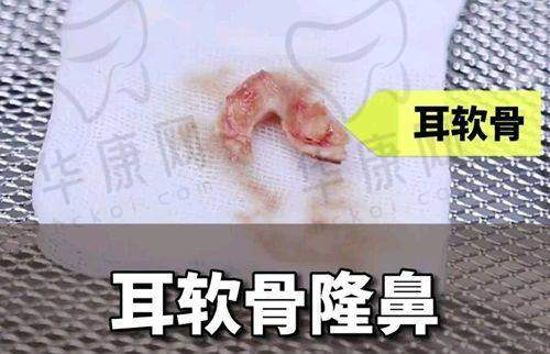 淄博正规的整形医院排行榜前五中有擅长眼部整形的吗?——淄博向东美容整形医院