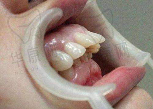 总结