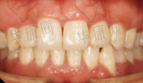 泰康拜博口腔的服务体验和价格透明度怎样?