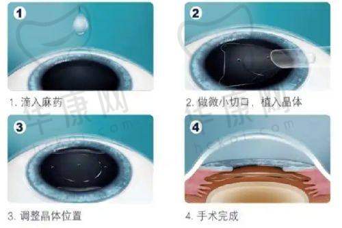 王红眼科医生坐诊医院地址在哪里?