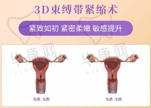 2024哈尔滨瑞丽整形医院双眼皮价格如何？