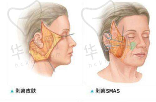 台州维多利亚医疗美容整形技术出色在哪?