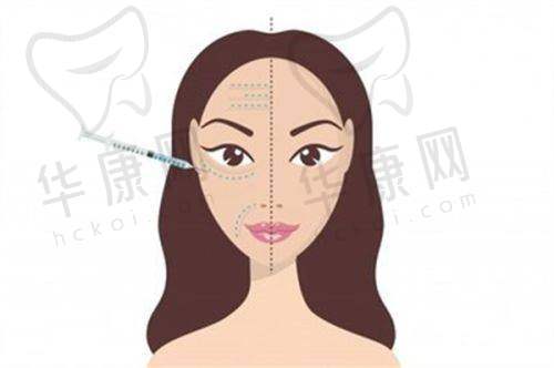 王旭明医生鼻子做得好吗：独特技术优势在哪里？