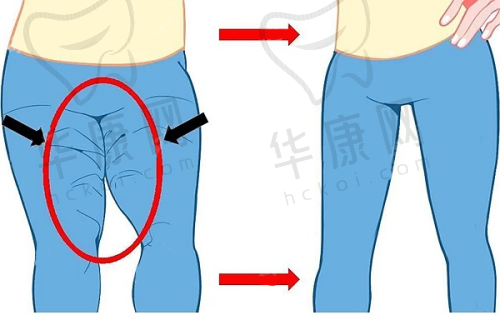 昆明梦想医疗美容医院的精良技术