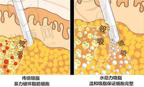 贵阳利美康医院骆显红医生特色技术优势