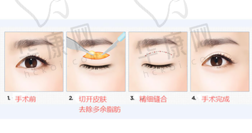 深圳八大处医疗美容医院怎么样？简介、预约、地址、口碑、医生、项目全知晓