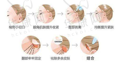 董开云医生预约方式