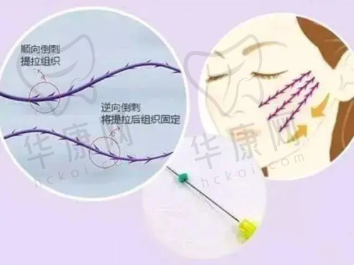 重庆美仑美奂整形美容医院毋巨龙特色技术优势