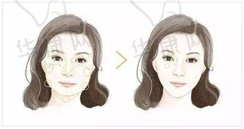 张立天磨骨怎么预约挂号?