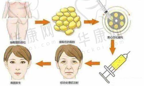 深圳八大处医疗美容医院口碑如何?