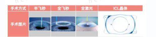 花3W在南通文慈眼科医院找张建做ICL晶体植入术很靠谱，告别模糊视界拥抱清晰未来