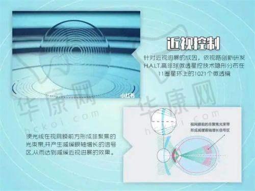 南昌大学第二附属医院眼科近视手术多少钱？激光 11800 起，多术式满足多样需求！