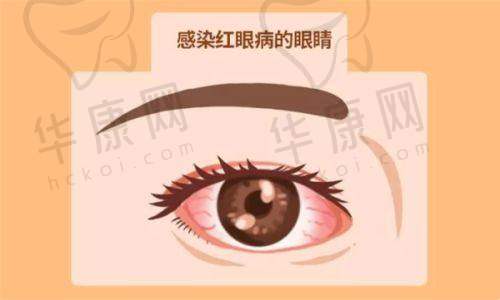 第一名：上海普瑞眼科医院（上海大学医学校附属眼科中 心）