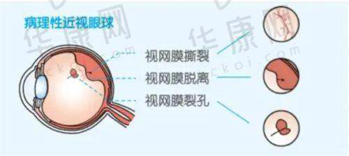 九江爱尔眼科医院联系方式与预约方式有哪些?