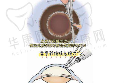 兴宁区|西乡塘区的南宁爱尔眼科医院实力如何?医院简介全知晓