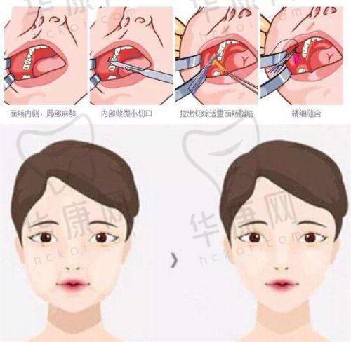 南京鼓楼美莱医疗美容沈正宇医生擅长项目