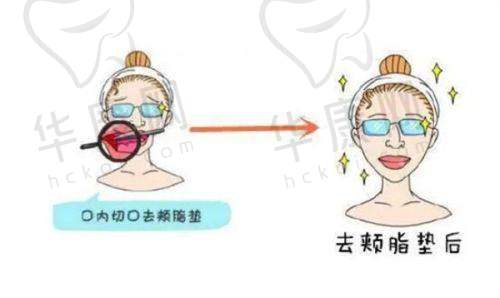修复过程与成效