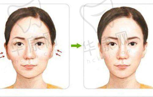 手术过程的感受