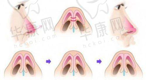 淄博正规的整形医院排行榜前五中有能量身定制的医院吗?——淄博美联臣整形美容医院