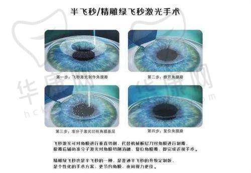 王红眼科医生联系电话是多少?