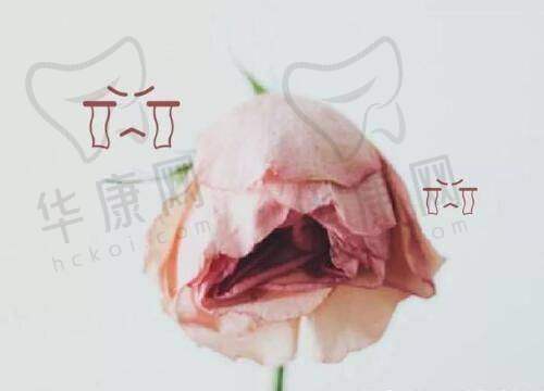祛斑治疗的具体体验
