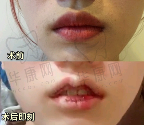 选择成都高新华生铂悦医疗美容的理由