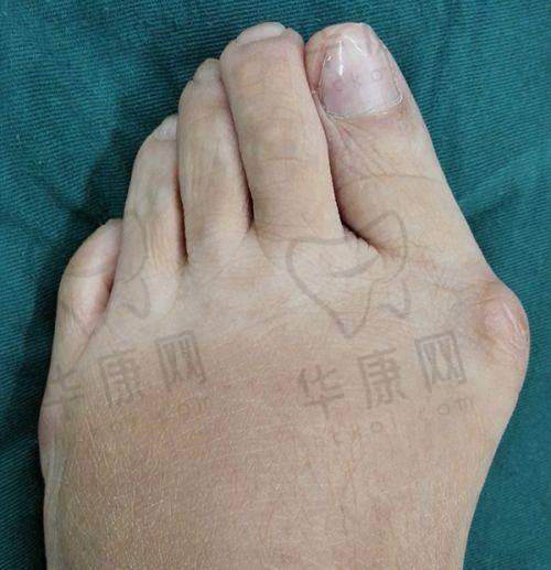 深圳美莱徐占锋医生的技术优势