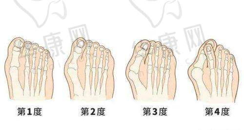张立天医生特色技术优势
