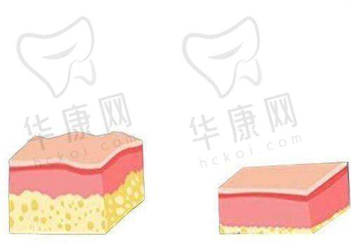 祛斑过程中的感受与变化