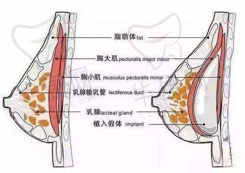温州艺星做双眼皮的医生及价格