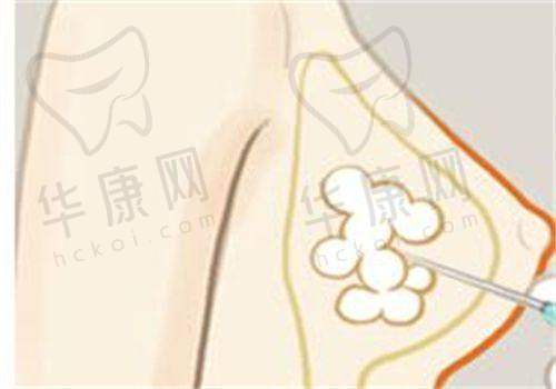 南宁帕拉美医疗美容医院口碑