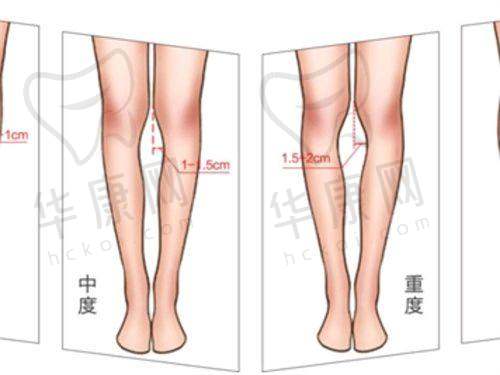 复诊护理：鼻小柱延长术后为什么要定期复诊？