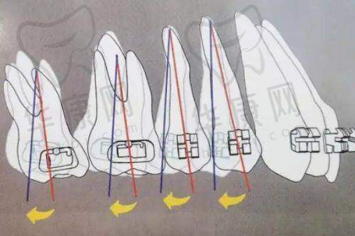 孝感植贝尔口腔儿童早矫的综合服务优势