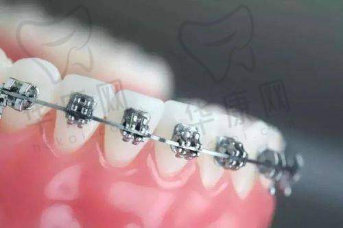 罗定好的牙科排名，拜伦、德馨、维齿美各有所长提供优质口腔诊疗选择